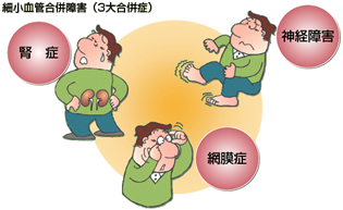 細小血管合併障害