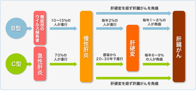 ウイルス性肝炎(B型肝炎、C型肝炎)